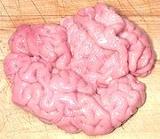 Brains