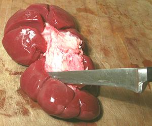 Whole Kidney